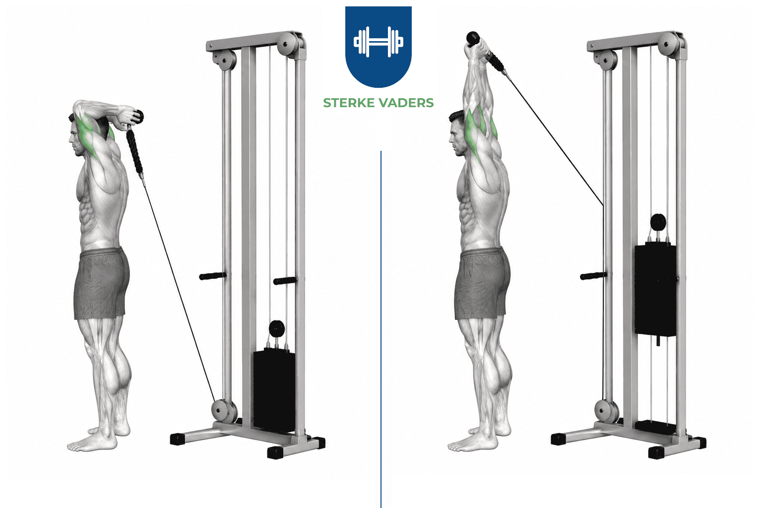 Overhead Cable Tricep Extension uitvoering stap voor stap